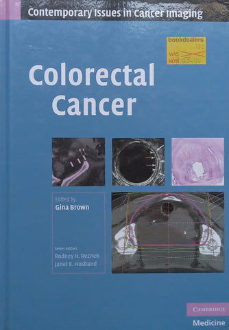 Colorectal Cancer (Contemporary Issues in Cancer Imaging Series) | Gine Brown (Ed.)