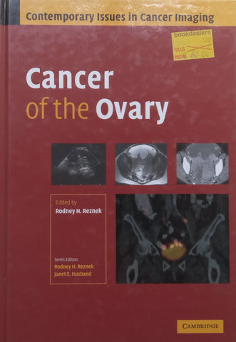 Cancer of the Ovary (Contemporary Issues in Cancer Imaging Series) | Rodney H. Reznek (Ed.)