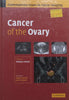 Cancer of the Ovary (Contemporary Issues in Cancer Imaging Series) | Rodney H. Reznek (Ed.)