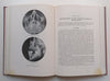 Dental and Oral X-Ray Diagnosis (Published 1954) | A. C. W. Hutchinson